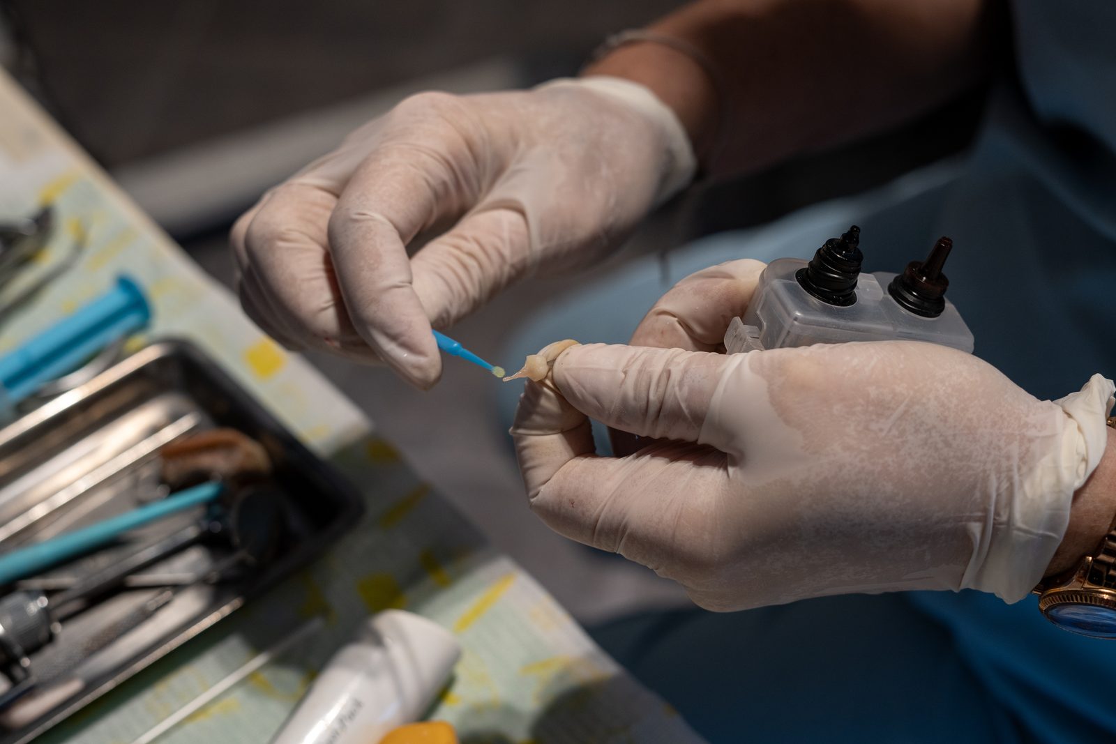 Detalle de las manos de un odontólogo preparando materiales de precisión